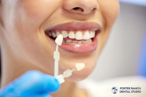 can-veneers-be-removed